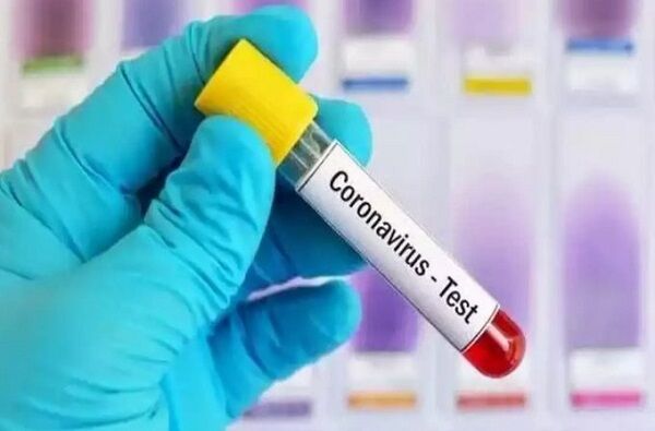 राजस्थान में कोरोना ने पकड़ी रफ्तार, 57 नए मरीज, 3636 हुई संक्रमितों की संख्‍या