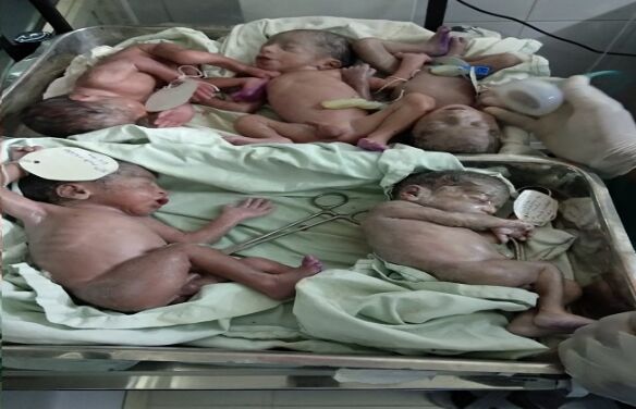 जयपुर के जनाना अस्पताल में 25 साल की महिला ने दिया पांच बच्चों को जन्म